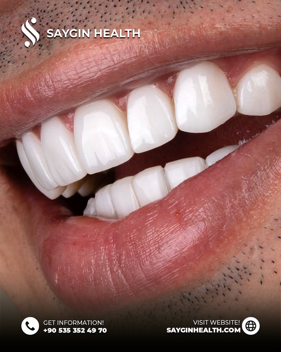 sayginhealth's tweet image. Transform your smile with confidence at Saygın Health

For more information and a free consultation:

🌐 sayginhealth.com
📩 info@sayginhealth.com
📞 +90 535 352 49 70

#smiledesign #hollywoodsmile #dentistry #cosmeticdentistry #veneers #porcelainveneers #estheticdentistry