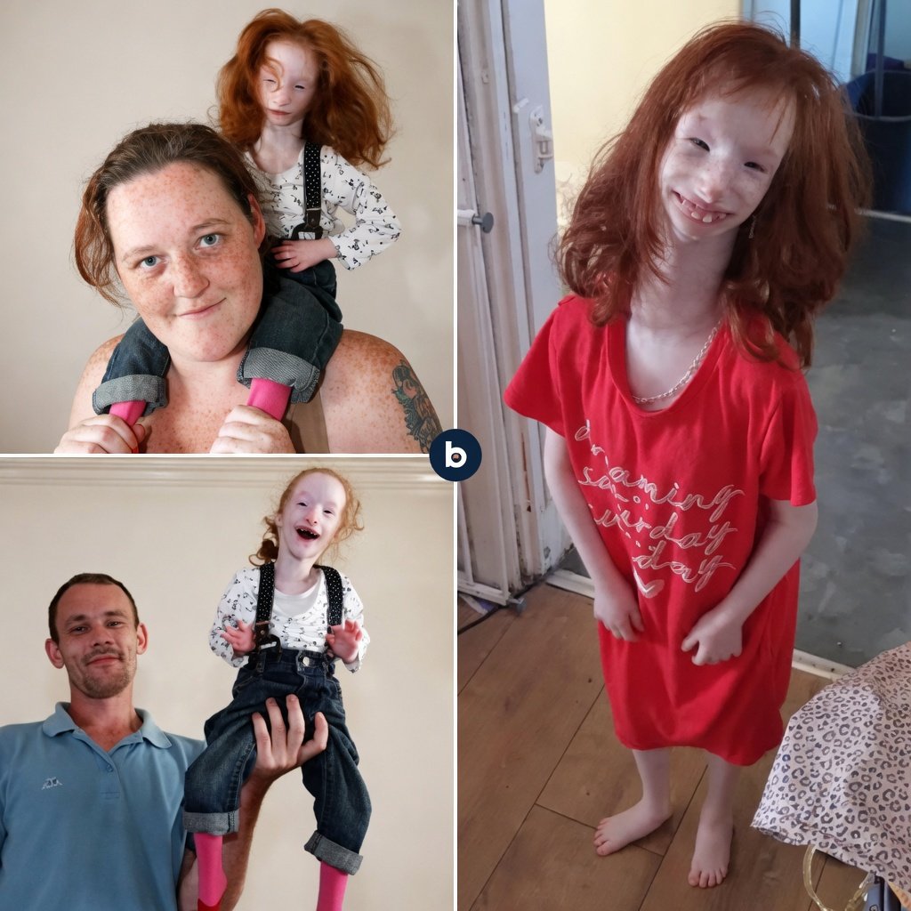 Doğduğunda bir kediden bile daha hafif olan Charlotte Garside, primordial dwarfism (doğuştan cücelik) teşhisiyle dünyaya geldi. Bu aşırı nadir hastalık nedeniyle boyu hâlâ çok küçük bir çocuğa benziyor.

Ailesi yıllarca onu “bebek” gibi korumaya çalıştı. Ancak Charlotte’un aklı