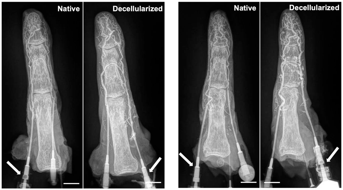 Bioeng_MDPI's tweet image. 💥Excited for the publication: "Decellularization of Human Digits: A Step Towards Off-the-Shelf Composite Allograft Transplantation"
🔗brnw.ch/21x22vy
📌 #TissueEngineering #RegenerativeMedicine #Decellularization #Biomaterials #Transplantation #BiomedicalEngineering