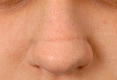 clarazepam tweet media