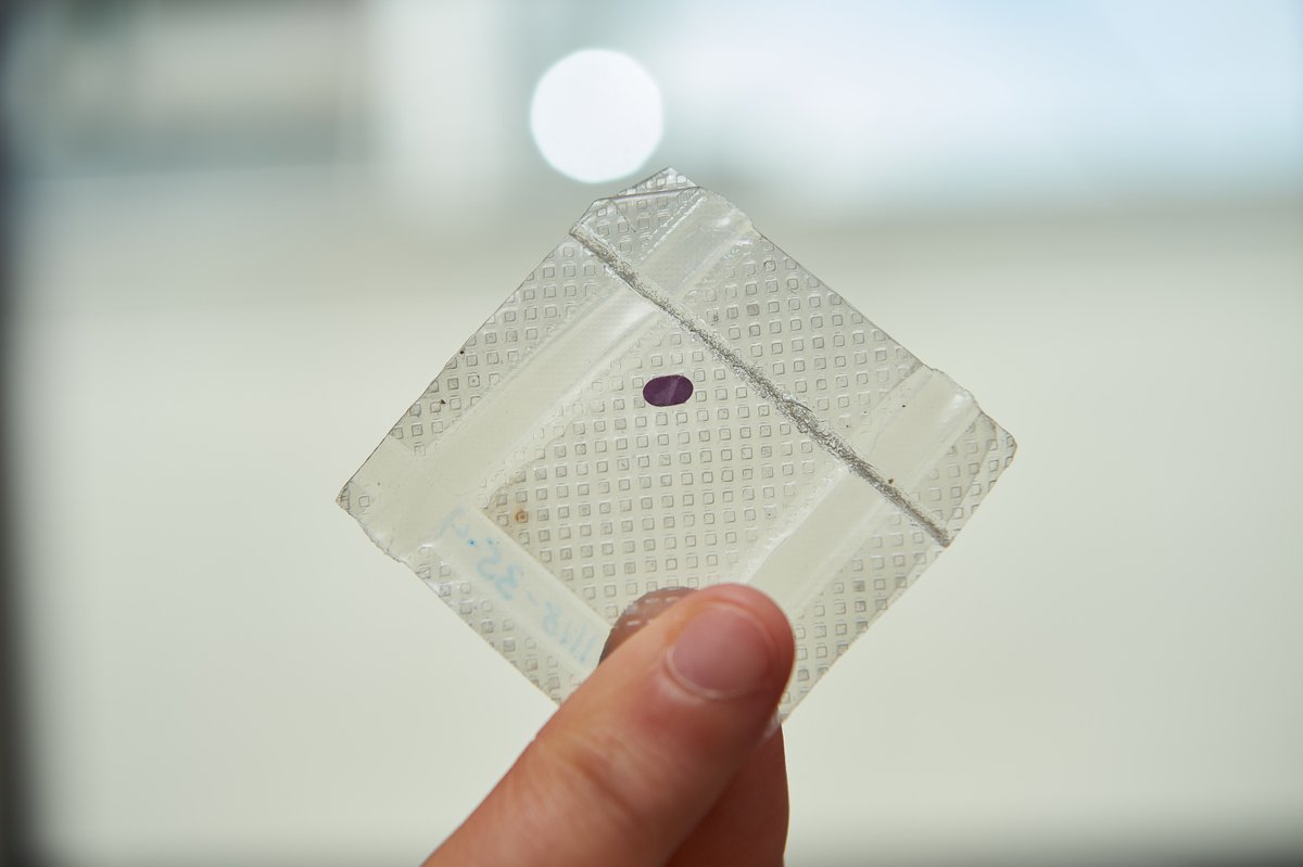 ISS_CASIS's tweet image. LambdaVision turned to space to improve production of its artificial retina—designed to restore vision for people blinded by macular degeneration. See how in-orbit manufacturing is helping make it possible. 
: ow.ly/TWWZ50YK4Wr

#Biotech #ISSResearch #Microgravity
