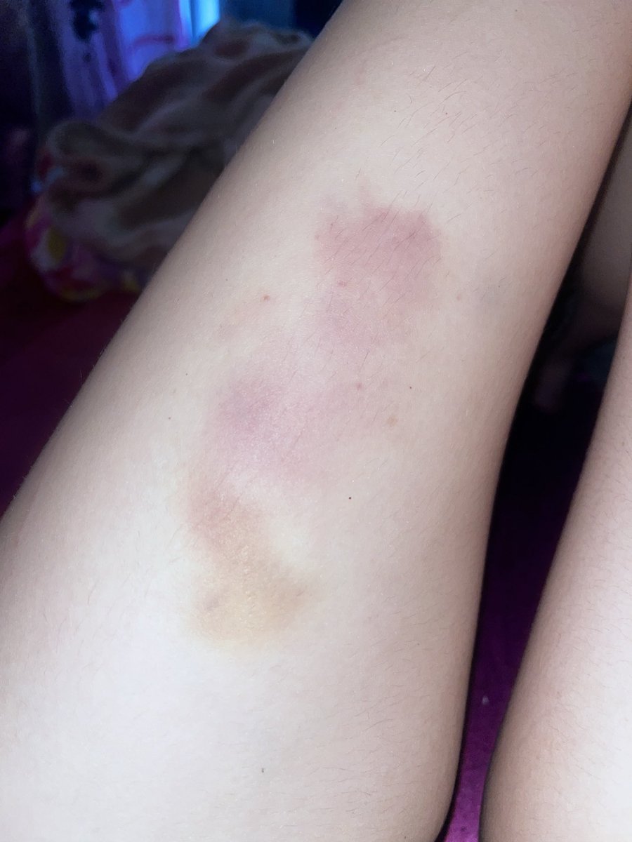 daily thinspo🪽 tweet media