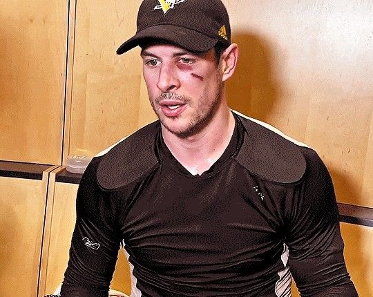 genocrisp's tweet image. he looks good even when his face is all purple and red ❤️ #wow #speakingfromtheheart