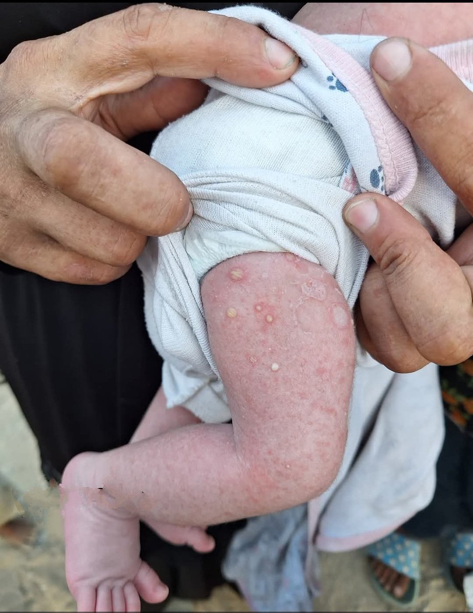 Yousef in Gaza 🇵🇸 tweet media