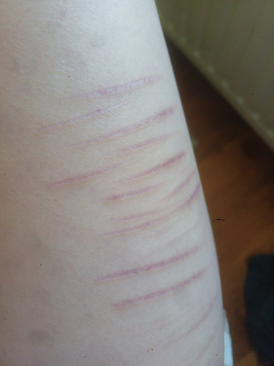 𓏵⸸ 𝓳𝓲𝓷𝔁𝓮𝓭 🤍 tweet media