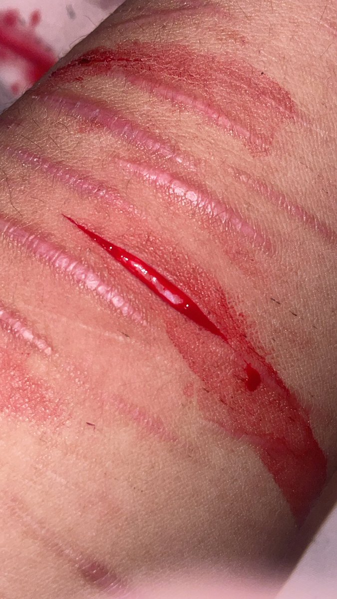 ҽოմ օբ sʜᴇᴅᴛᴡᴛ!!♡ tweet media