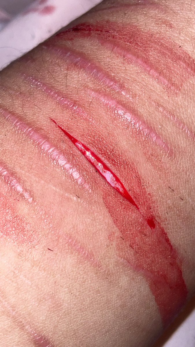 ҽოմ օբ sʜᴇᴅᴛᴡᴛ!!♡ tweet media