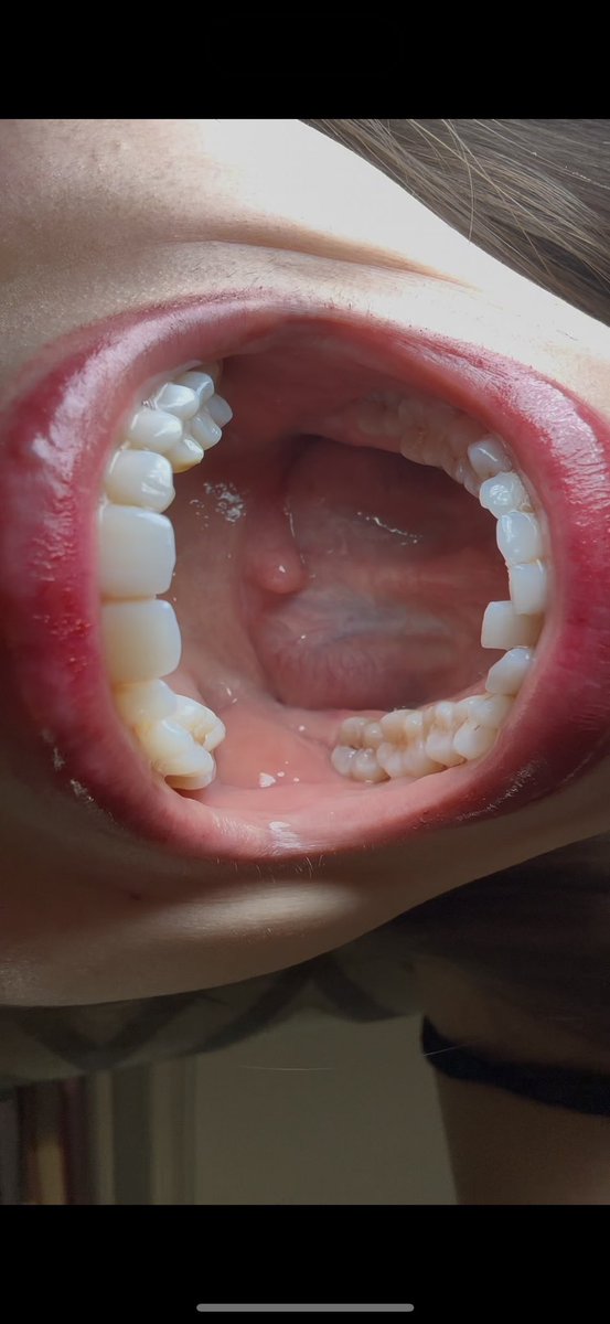 itsashleydamico's tweet image. Reposting my long tongue down my throat trick pics!! 
#longtongue #vore #fyp #girlswithlongtongues #prettygirls