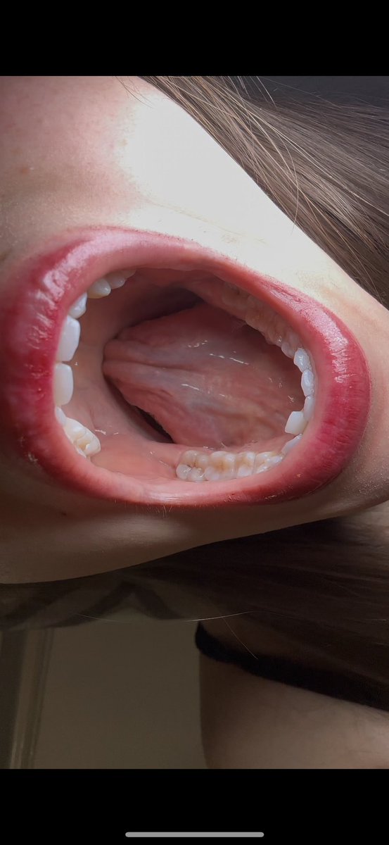 itsashleydamico's tweet image. Reposting my long tongue down my throat trick pics!! 
#longtongue #vore #fyp #girlswithlongtongues #prettygirls