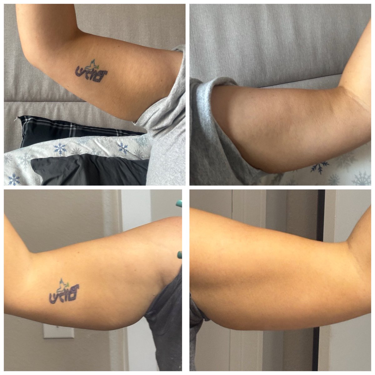 StrosSteph's tweet photo. Glow Up Day 37 💪✨
Last month vs today… the resistance bands are doing their thing.
Stronger arms, more definition, more confidence. Small steps add up.
#GlowUp #ProgressPic #FitnessJourney https://t.co/5u0LjsHLvi
