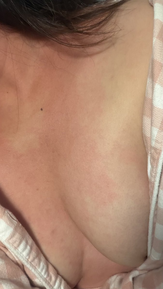 小木头 tweet media