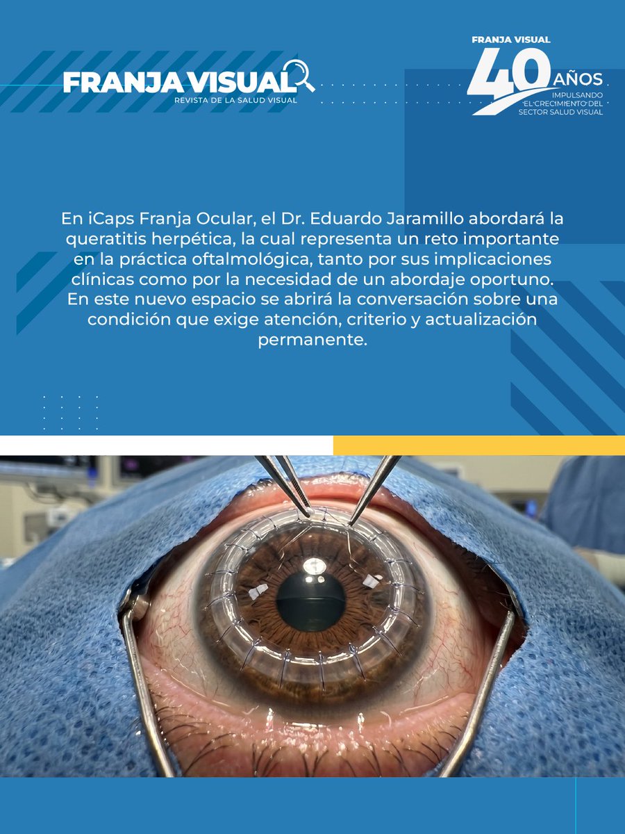 FranjaVisual's tweet image. #Webinar La creación de espacios y asociaciones orientadas a la educación en lentes de contacto será el eje de una nueva conversación del sector.

Únete hoy con #IACLE a las 11:00 a.m. (Hora Col)

🔴 Transmisión en vivo: YouTube TVFranja
🔁 Retransmisión: 7:00 p.m por linkedin.