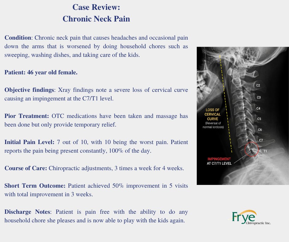 FryeChiro's tweet photo. Daily neck pain, headaches, and arm pain. 
X-rays showed loss of the cervical curve with pressure at C7/T1.

After care:
50% better in 5 visits. 
Pain-free in weeks.
Back to normal life. 

#neckpain #chiropractic #antelopevalley #painrelief https://t.co/r2xadJ4hW9