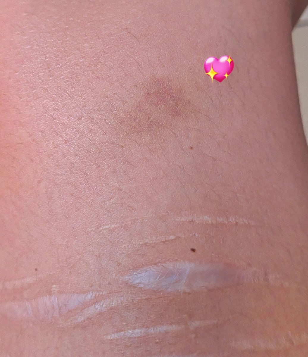 peye 🫧 tweet media