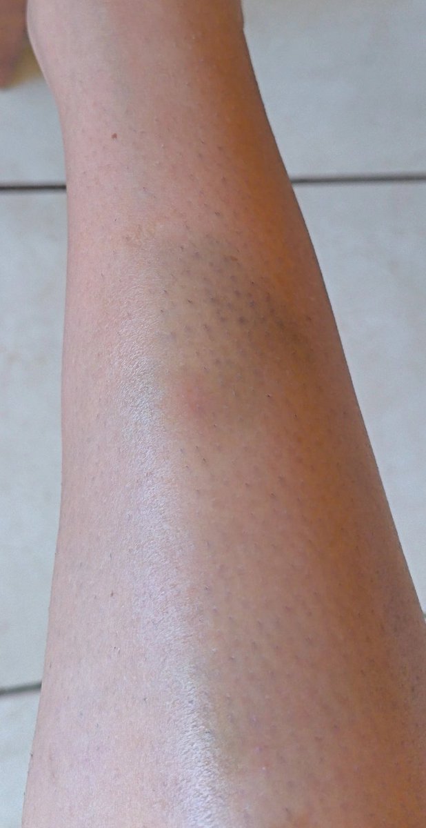 peye 🫧 tweet media