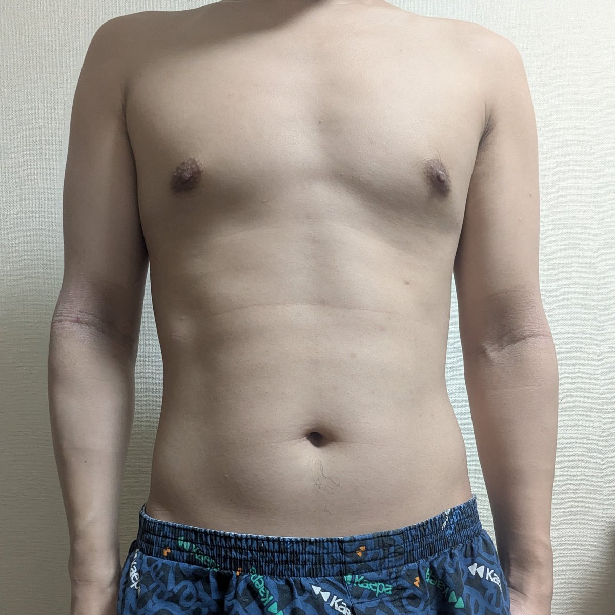 temolife1's tweet photo. 20260427
162.7cm
60.7kg
24.2% https://t.co/RyewlWU33A