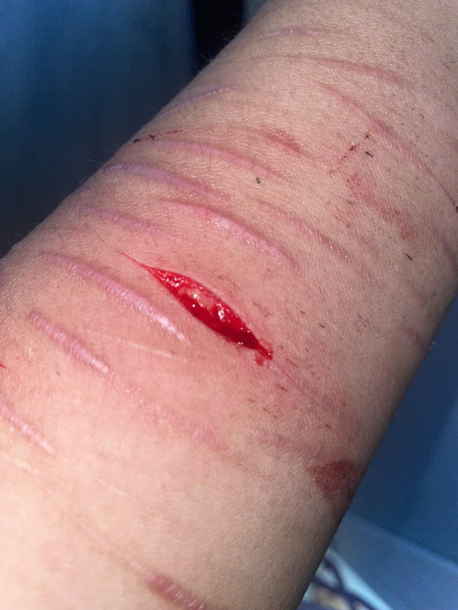 ҽოմ օբ sʜᴇᴅᴛᴡᴛ!!♡ tweet media