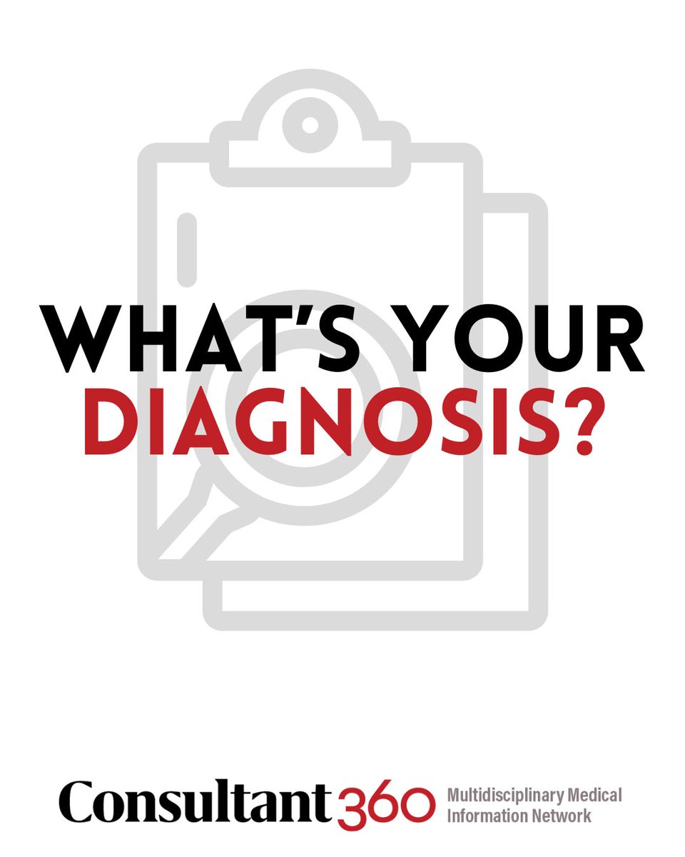 Consultant360's tweet image. A young woman with progressive oral pigmentation, fatigue, dizziness, salt cravings, and weight loss: what’s your diagnosis?

Test your clinical reasoning here: tinyurl.com/mrxjud9a  

#WhatsYourDiagnosis #ClinicalChallenge #MedicalEducation