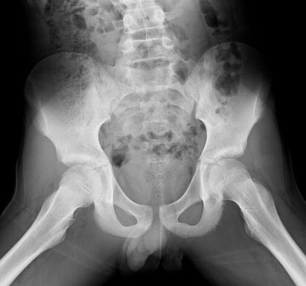 PTE Gahene tweet media