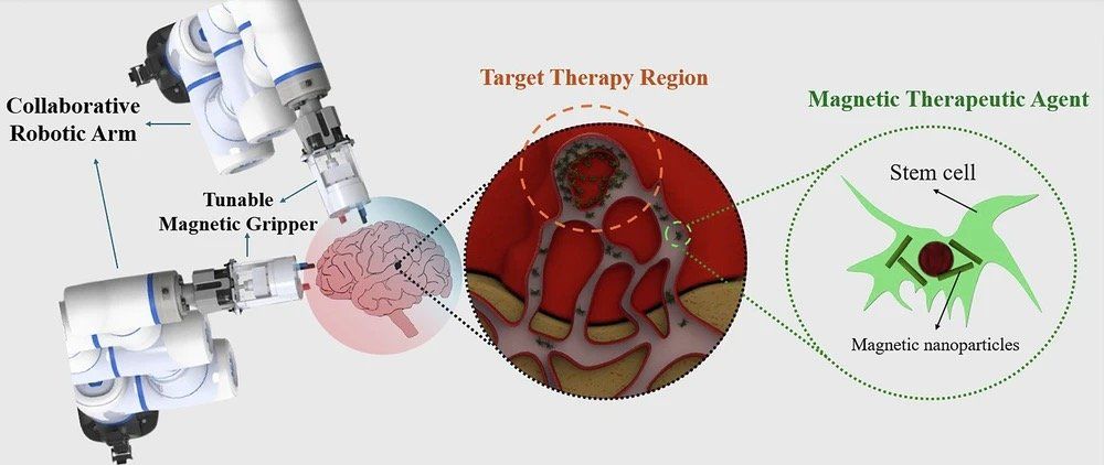 GizmoMD_'s tweet image. Magnetic Microrobotics Could Revolutionize Targeted Cancer Treatment - gizmo.md/2026/04/29/mag… #medtech