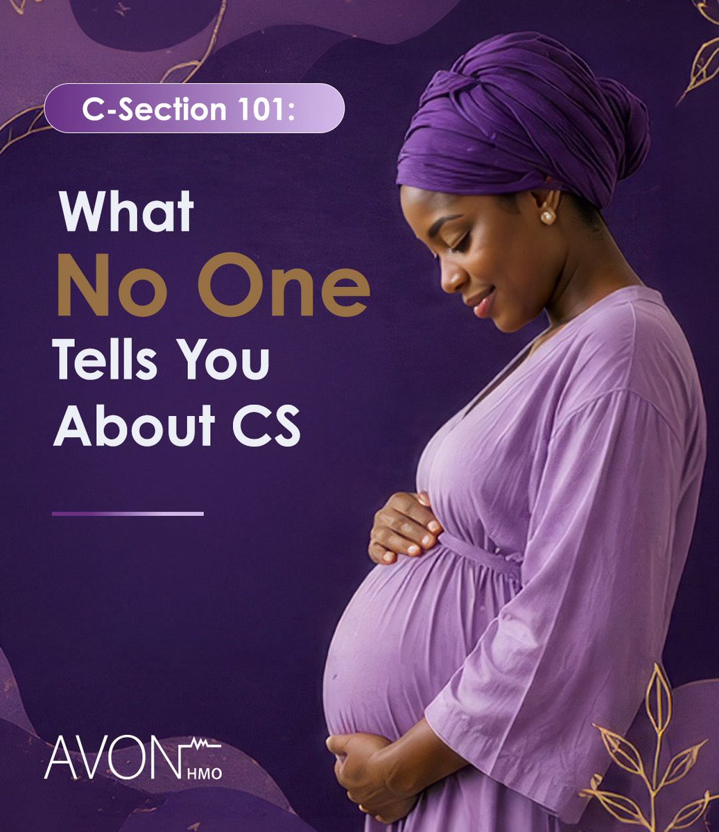 Avon HMO tweet media