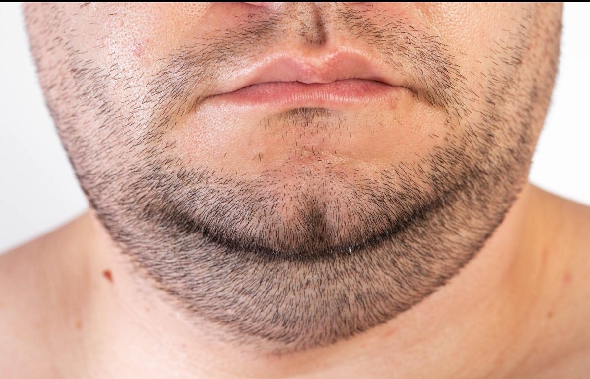 La grasa facial y la papada te hacen parecer mayor de lo que eres.

Aquí te mostramos los pasos para eliminar la grasa facial de forma permanente y natural.