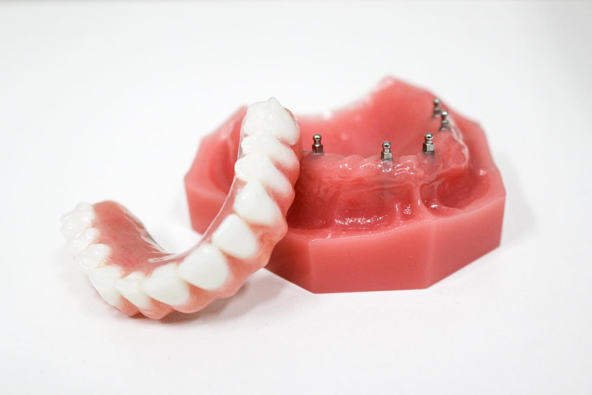 rickmillerdds's tweet image. Snap in dentures offer much greater stability and comfort than traditional ones. Book a free consultation to enhance your smile! #dallas #dentalimplants #dentist bit.ly/4caXUH6