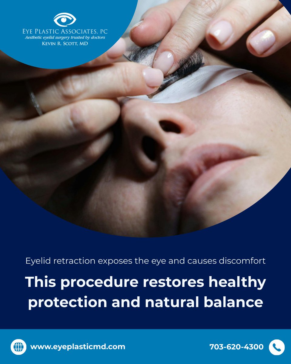 EyePlasticAssoc's tweet photo. Eyelid Retraction Repair restores lid height, improving comfort and appearance. How much does eyelid position affect expression? https://t.co/LmpA6oRae5 

#EyelidRetraction #EyeHealth #Oculoplastic #VisionProtection #NorthernVirginia https://t.co/3BOY2lUQR0