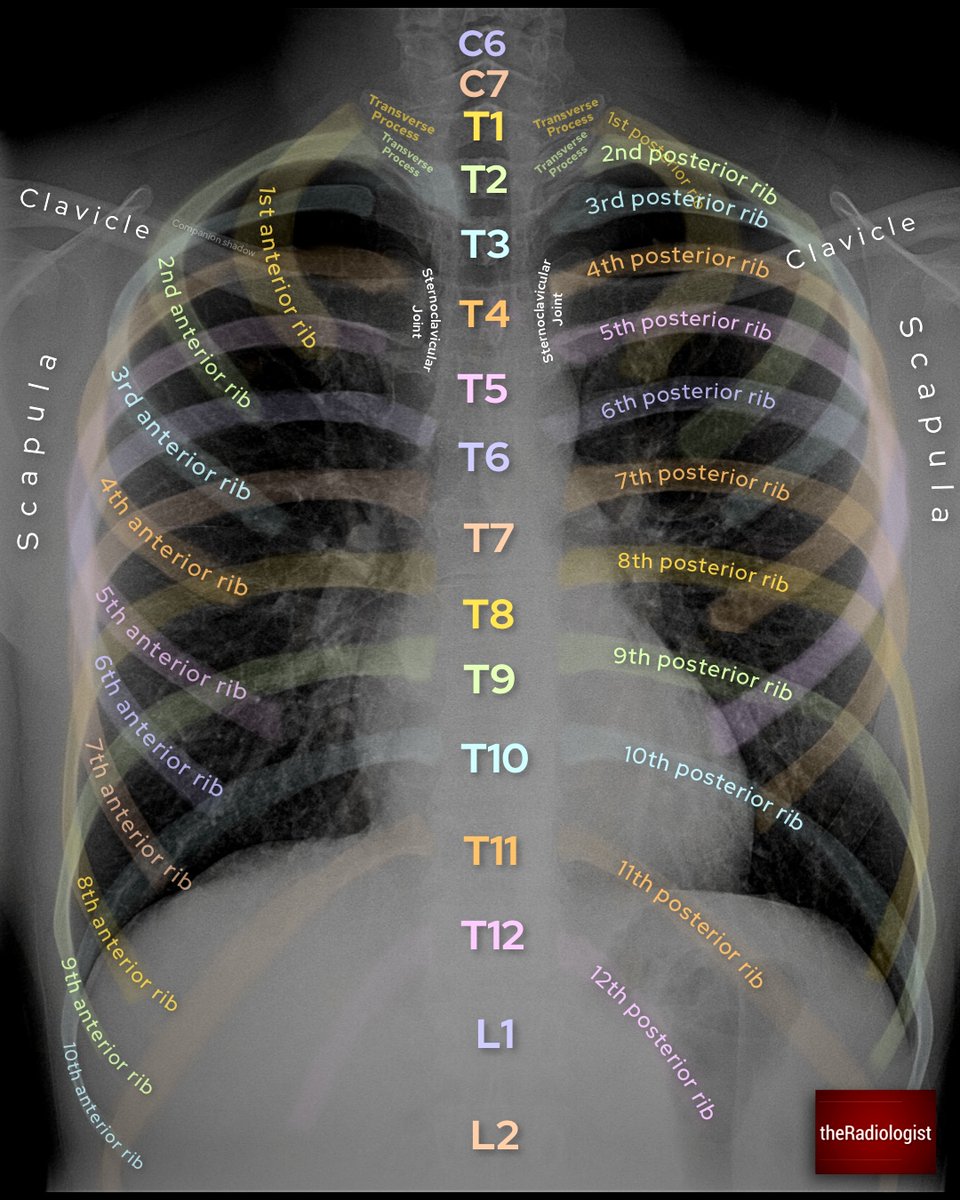 radiologistpage's tweet photo. Chest X-Ray review areas and anatomy https://t.co/etMJ7a1OGz
