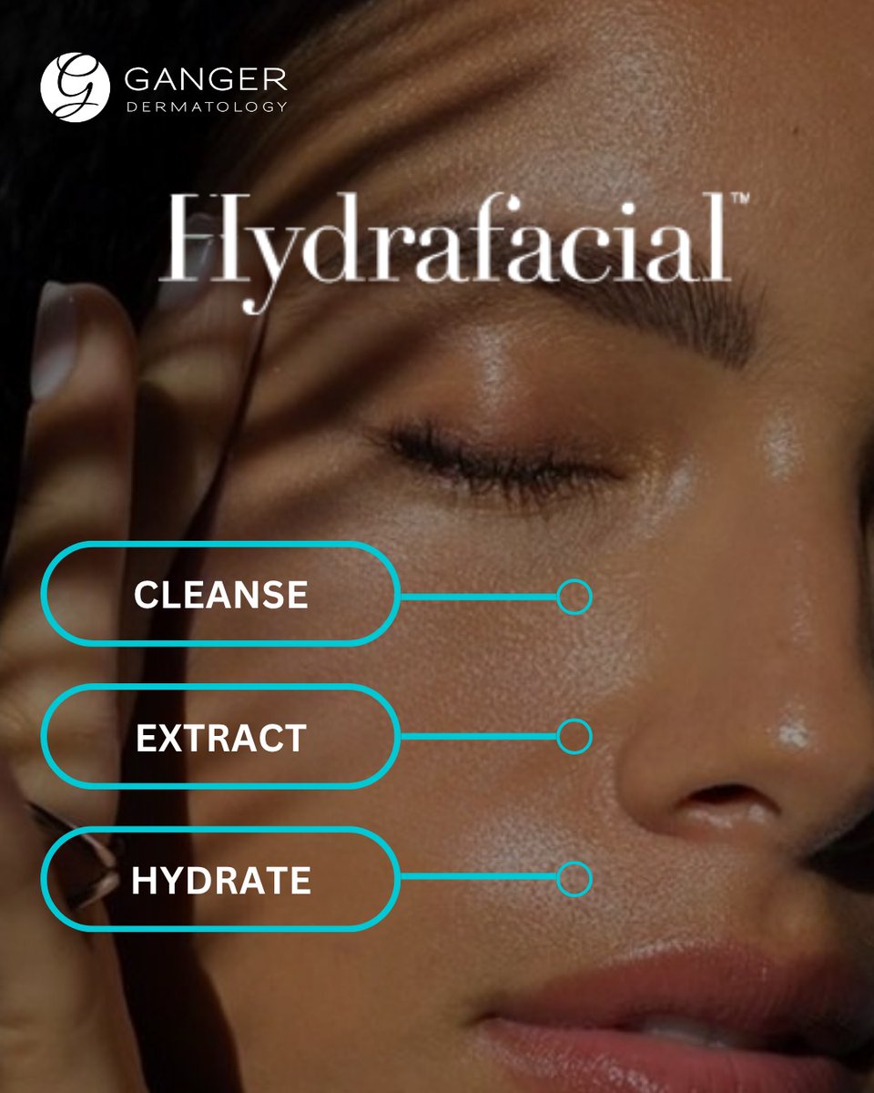 GangerDerm's tweet photo. HydraFacial Special with Sofia
Reveal cleaner, smoother, healthier-looking skin with our advanced HydraFacial treatment, designed to deeply cleanse, exfoliate, extract impurities, and hydrate the skin. HydraFacial uses gentle vortex technology to help remove impurities while infusing the skin with nourishing serums.
For a limited time only, prepay for 4 Deluxe HydraFacials and receive 1 complimentary Perfect Peel Plus and a SkinBetter Science InterFuse Treatment Cream EYE 15 mL.
This offer is available exclusively with Sofia at our Plymouth and Ann Arbor locations.
If your skin is ready to feel refreshed and rejuvenated, call today to schedule your consultation!
