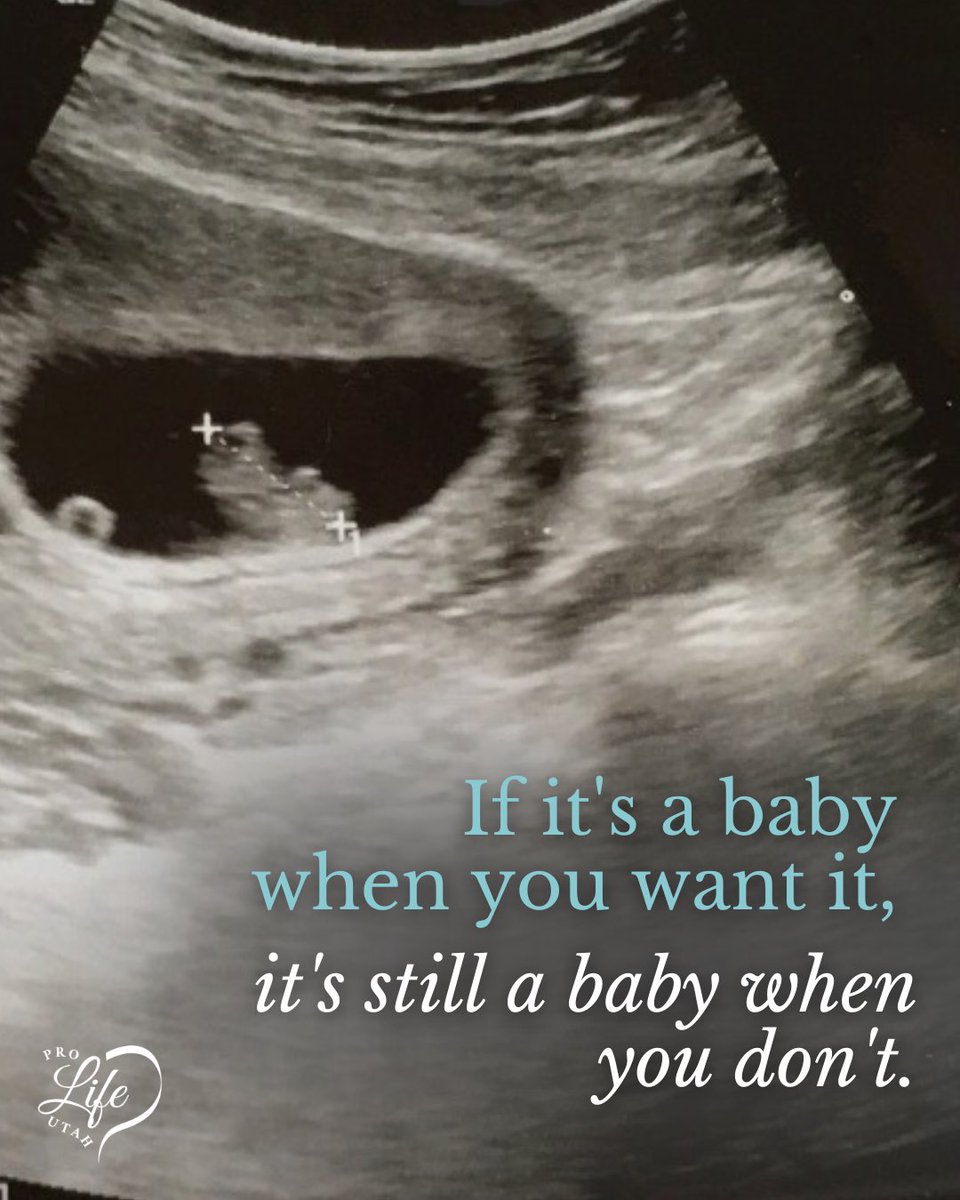 prolifeutah's tweet image. Value doesn’t depend on timing, convenience, or circumstance. A child doesn’t become less human because their arrival is unexpected or unplanned. #prolife #prolifegen #savethebabies