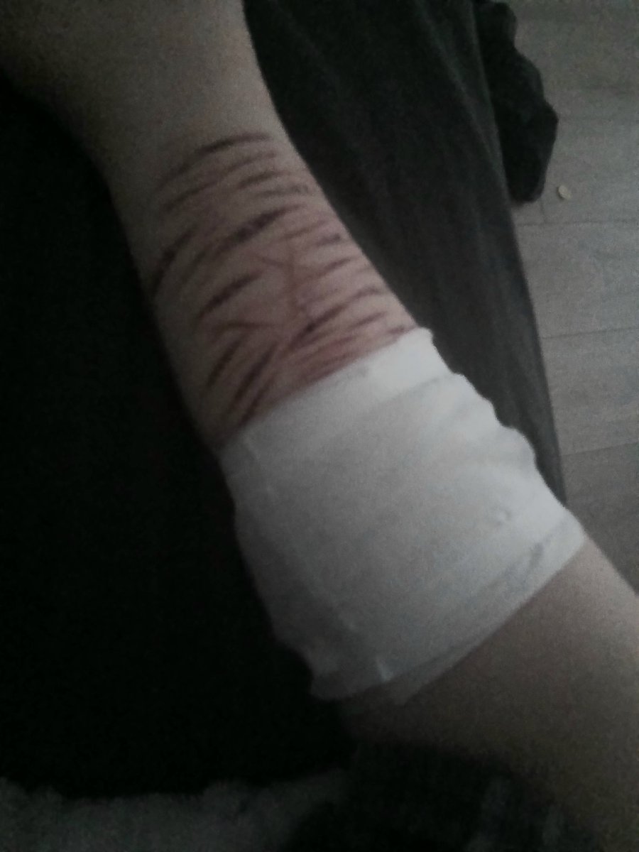 HAZARDDOZED's tweet image. Mother bought me more dressings, atleast now they're properly being taken care of
#998twt #shtwt #shedtwt #slittwt