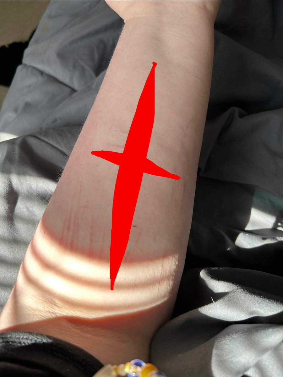 mxCyberOverdose's tweet image. I wish I could do a cut like this on my arm but unfortunately my parents would notice and yell at me 🫩
#shedtwt #shtwt