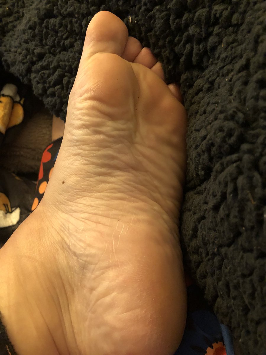 MsLucysroom's tweet photo. Stupid bitch paid for the pedicure and the pictures. When we he learn. I always give his exclusive pictures away for free!

(Footslave, footsub, findom, finsub, footworship, feet, soles, toes) https://t.co/oBW1lkame4