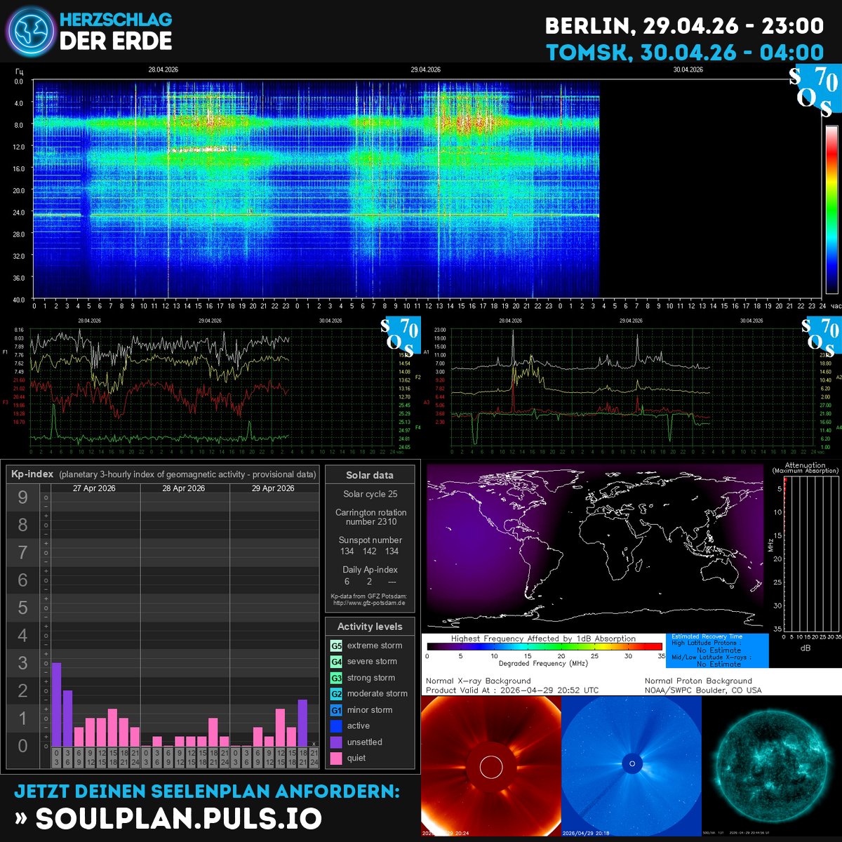 SchumannBotDE's tweet image. 🌍✨ Today's cosmic pulse shows active geomagnetic waves &amp;amp; powerful solar energy flowing through Earth's heartbeat! 💫 Feel the awakening resonance within—your inner compass is aligning with the universe. 🧭 kompass.herzschlag-der-erde.de #Schumann #SolarEnergy #CosmicAwakening