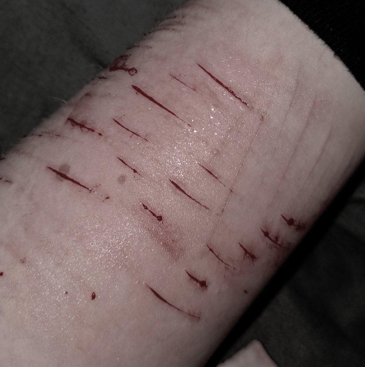 ׄꆬׁ݂ ̼̬︧𝖆𝖑𝖊𝖝◞ 𝖕𝖚𝖕𝖙𝖜𝖙𓈒ׄ tweet media