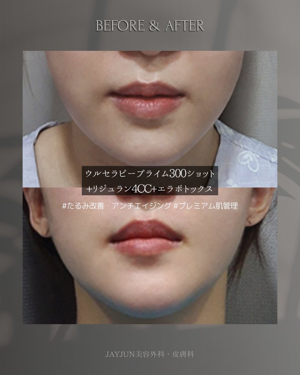〚公式〛JAYJUN美容外科•皮膚科｜韓国美容 tweet media
