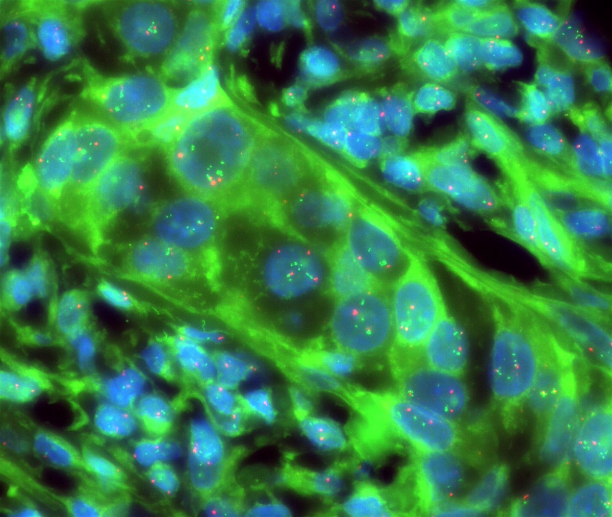 Optolongfilter's tweet photo. New Optical Scientific Photographic Artist / Amateur photomacrographer, @Peter Braubach
- Optolong DAPI/Green/Orange fluorescence filter sets 
- Olympus BX61 with a 100x UPlanSApo Oil immersion objective
- Illuminated by a coolLED pE-300 white, - Andor Zyla 5.5 sCMOS camera https://t.co/e8wQYeVKKg