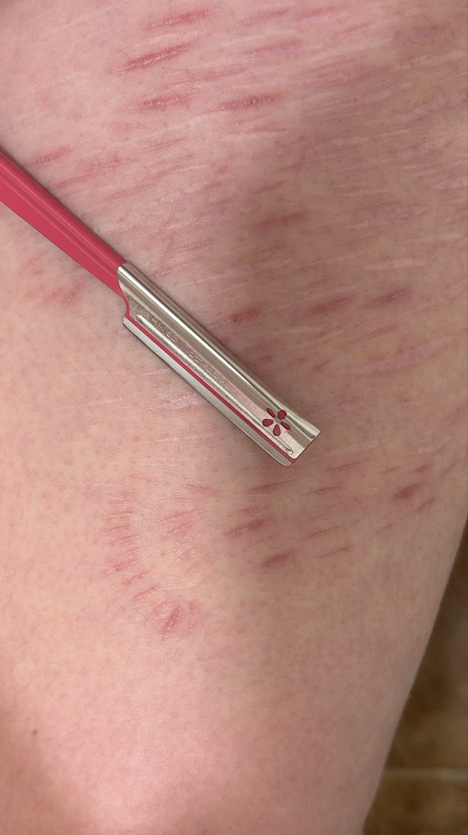 𑁤 𝜗𝜚 pearl of shedtwt .ᐟ.ᐟ 𓇢𓆸 tweet media