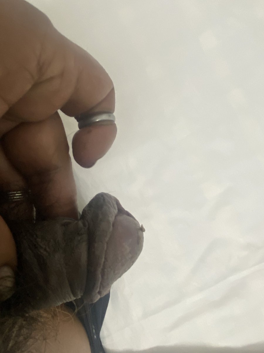 CHarassed's tweet photo. Bearing the brunt of highly advanced Radio-wave and Microwave technologies for creating lesions on genitals even while I have them protected with metal shields…

#GangStalkingRegimeOfTerror
#CovertTorture
#StasiState
#TargetedIndividuals https://t.co/NTNvqBRxLM
