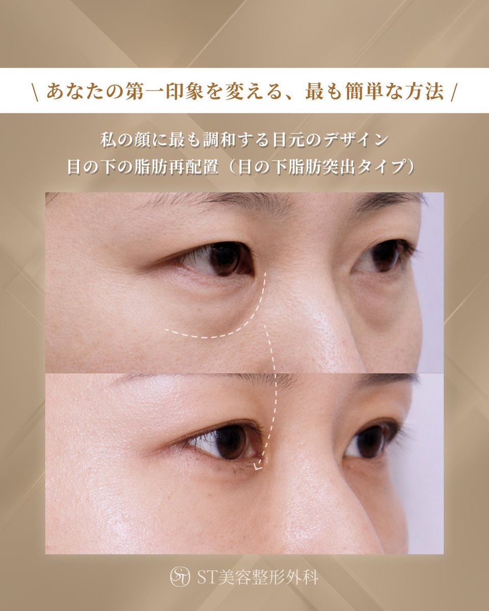 韓国ST美容整形外科 tweet media