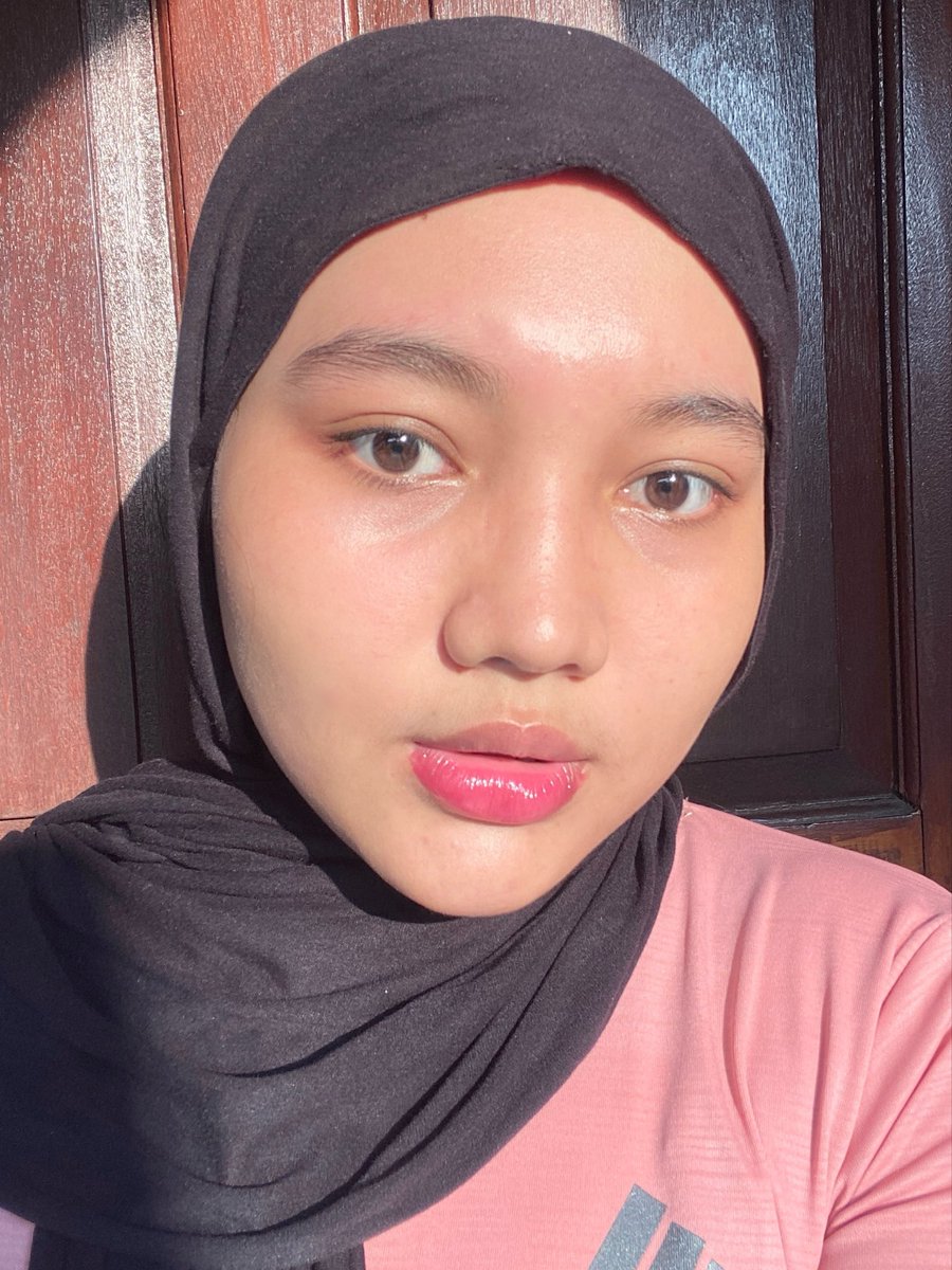 inget DNA Salmon, inget Dermies Max.  jujur ini treatment yang bikin muka aku berubah banget…
 dari kusam ➝ glowing seger 😭 (a thread)