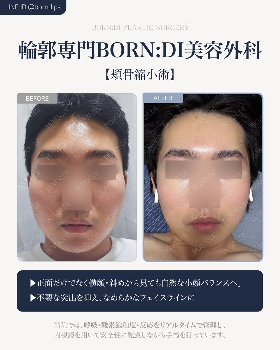 韓国ボンディ美容整形外科 BORN:DI PLASTIC SURGERY tweet media