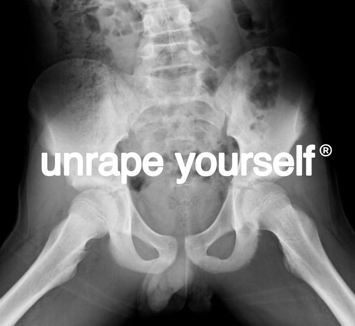 CryptoFeendZ's tweet photo. @PepeNukes @orangie rectum? Damn near killed him https://t.co/65ld1iTT6c