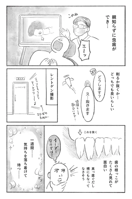 親知らず抜く(再掲) 