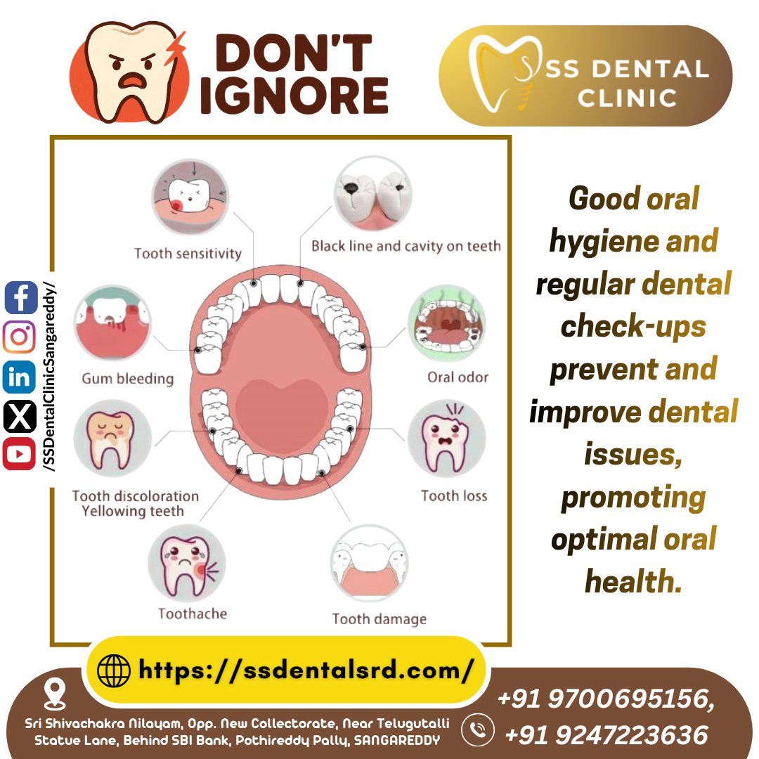 SSDentalClinics's tweet image. #SSDentalClinic #Sangareddy #DontIgnore #ToothSensitivity #CavityPrevention #GumHealth #ToothacheRelief #SangareddyDentist #OralHygiene #DentalCheckup #HealthySmile #DrShivaRamaKrishna #DrShivaratna #SmileCare #DentalHealth #ToothDamage #SangareddyDistrict #PainlessDentistry