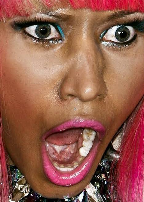 R9-ROBYN tweet media