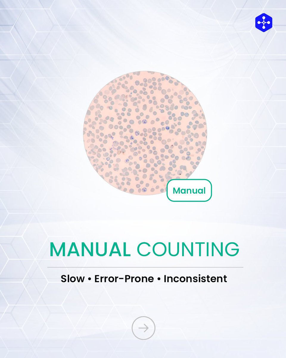 medprimetech's tweet photo. Tired of the 30-minute manual retic grind? The Cilika Retic AI module is here to change the game. By automating the identification of immature red blood cells, we’ve turned a tedious task into a 2-minute precision report.

#CilikaRetic #DigitalMicroscopy #AILab #PathologyTech https://t.co/hPkXHYqwQV