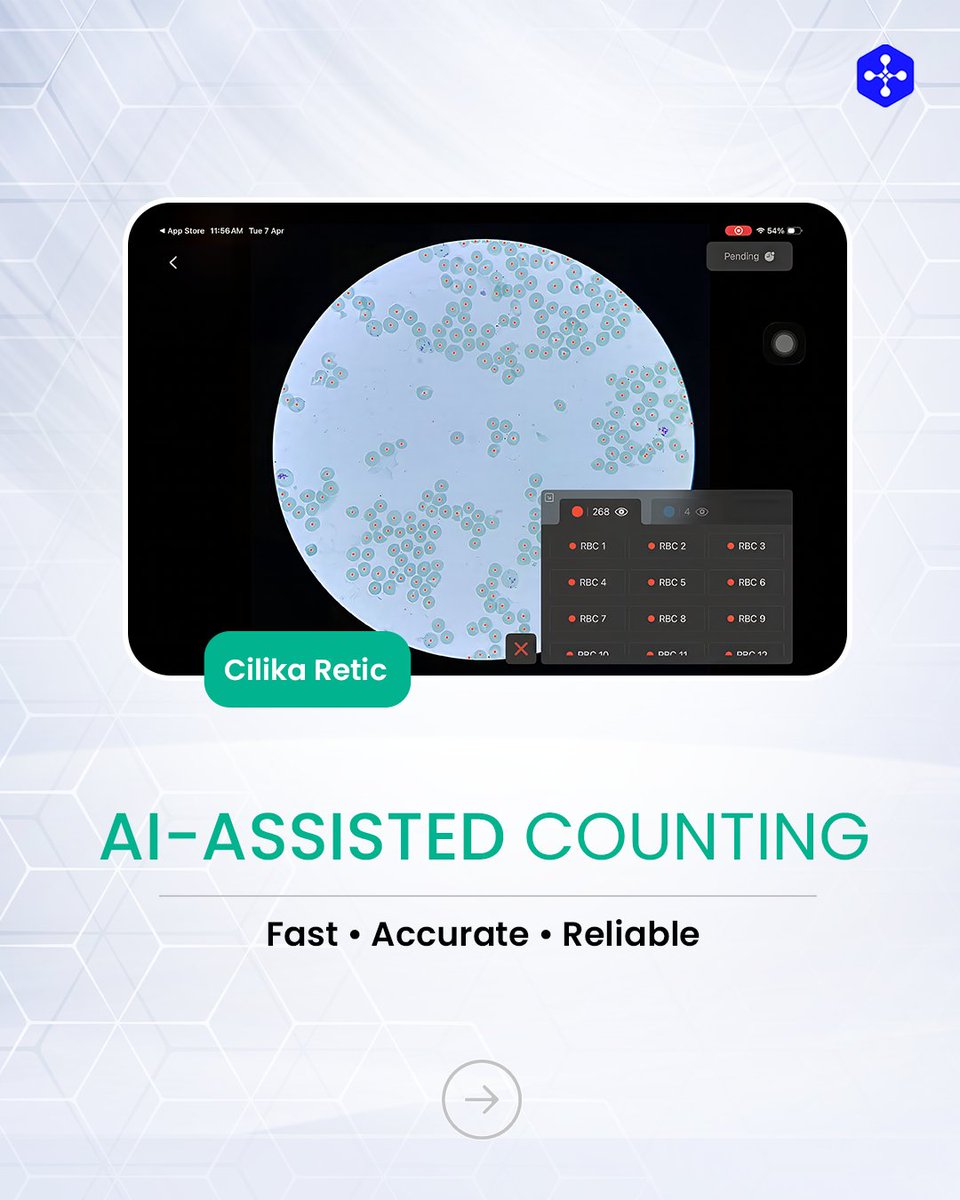 medprimetech's tweet photo. Tired of the 30-minute manual retic grind? The Cilika Retic AI module is here to change the game. By automating the identification of immature red blood cells, we’ve turned a tedious task into a 2-minute precision report.

#CilikaRetic #DigitalMicroscopy #AILab #PathologyTech https://t.co/hPkXHYqwQV