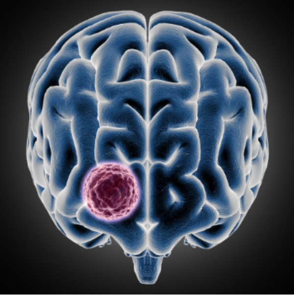 Dr.Avinash Talele (MD DM medical oncology ) tweet media